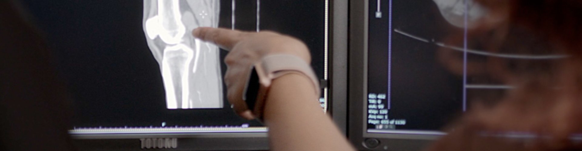 Veins and Venous Disease Veins and Venous Disease
